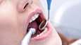 Kerro hammaslääkärin tai suuhygienistin vastaanotolla happamien tuotteiden käyttötavoistasi.