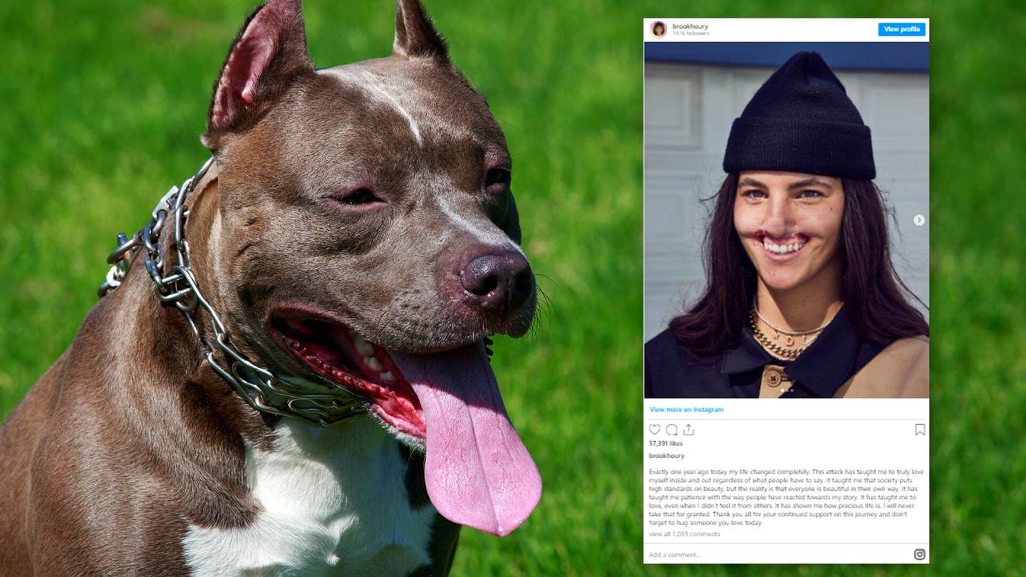 Karu kuva: Brooklinnilla, 22, ei ole enää ylähuulta – painajainen alkoi kohtaamisesta serkun koiran kanssa