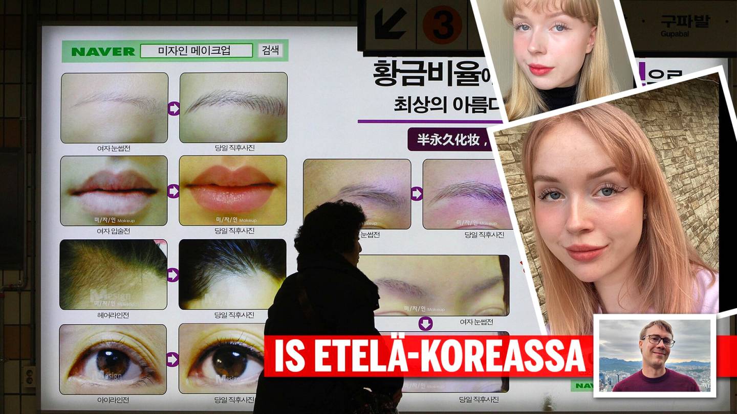 Veera, 22, muutti Etelä-Koreaan ja kävi ”maan tavan” mukaisesti kauneusleikkauksessa – yllättyi reaktiosta somessa