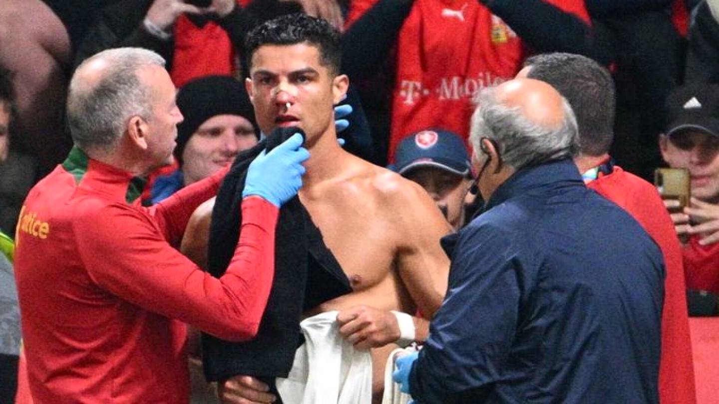 Täystyrmäys! Cristiano Ronaldo sai maistaa Tshekin maalivahdin nyrkkejä – kasvot menivät huonoon kuntoon
