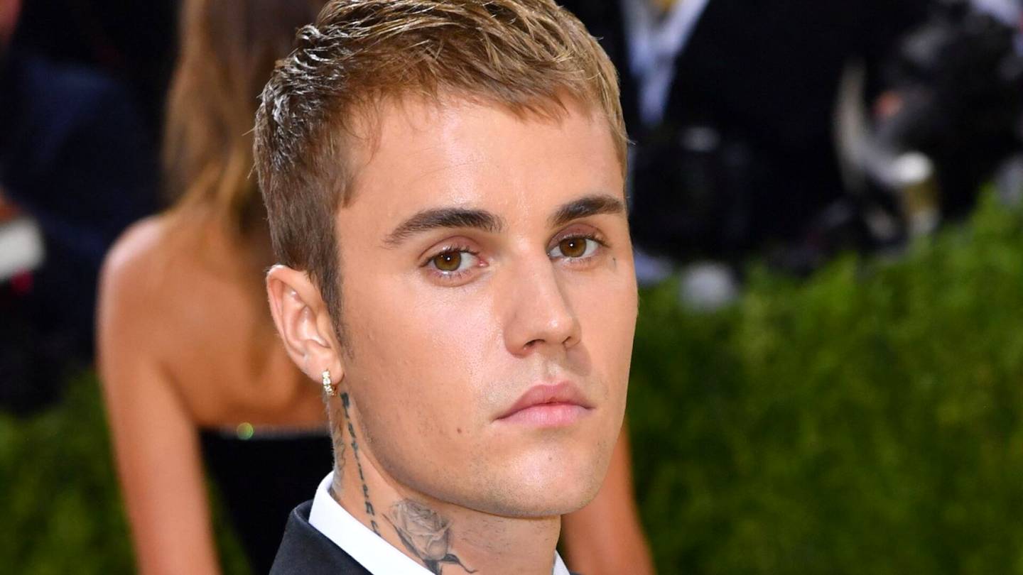 Justin Bieber paljastaa sairastavansa harvinaista oireyhtymää – kasvot halvaantuivat