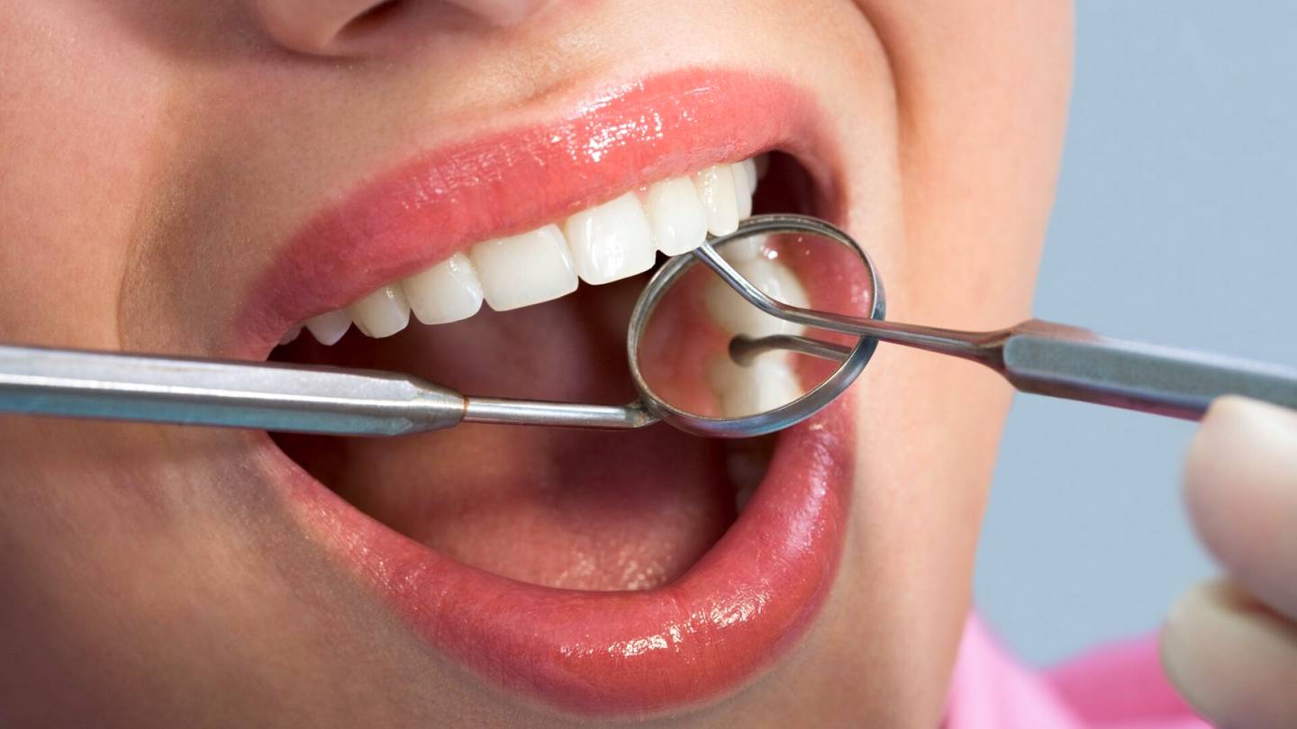 Voiko hammaslääkäri todella nähdä suusta, että olet harrastanut suuseksiä? Selvitimme