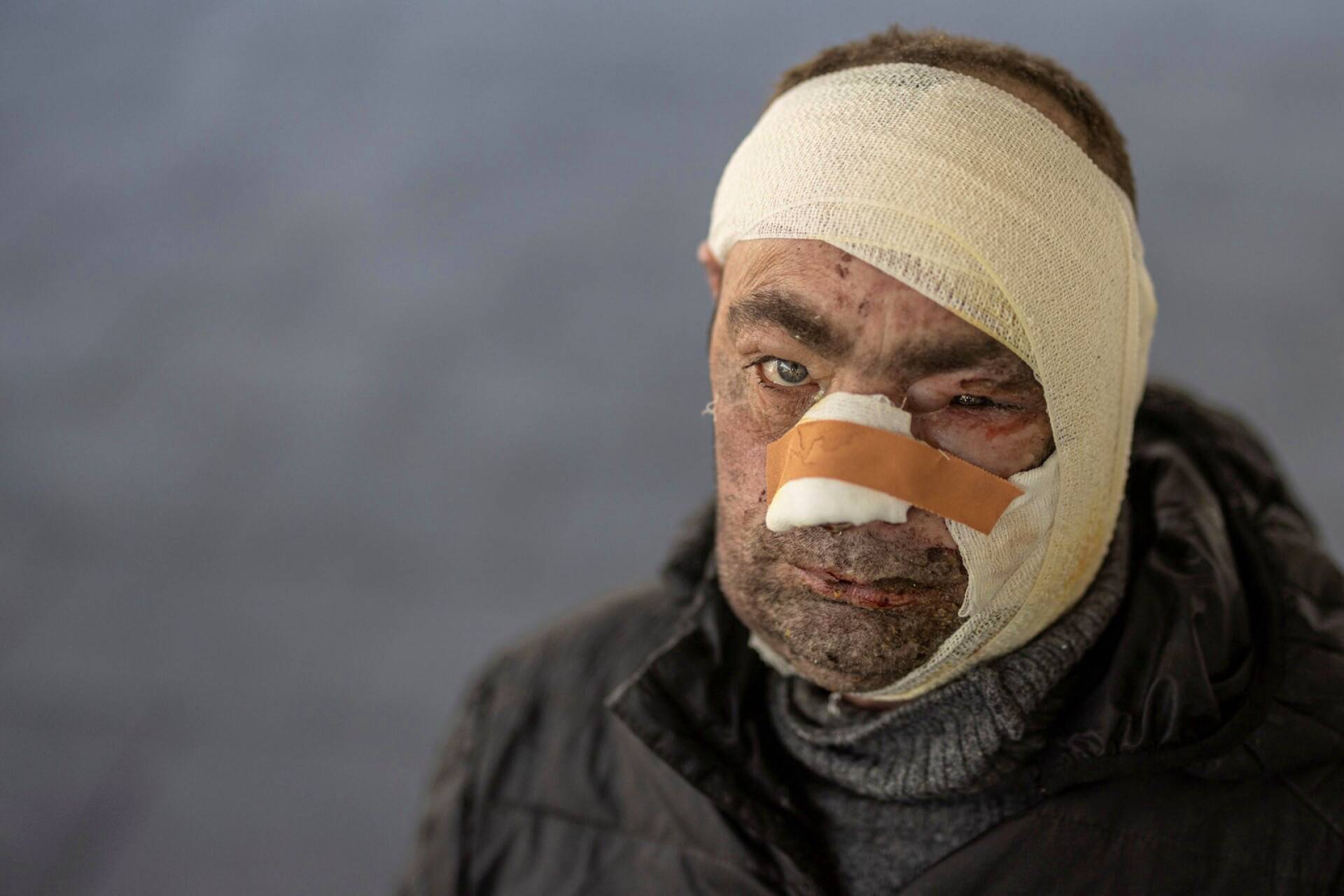 Venäjän iskussa haavoittunut ukrainalaismies sairaalan edustalla Brovaryssa.