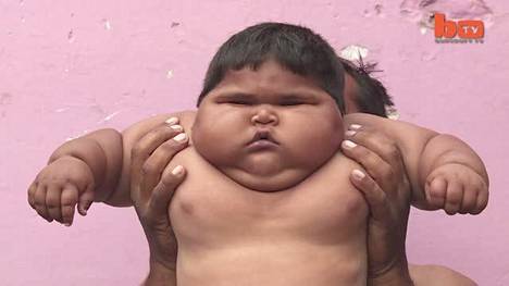 10-kuukautinen Aliya-vauva painaa 18,7 kiloa – lääkärikin hämmästyi - Perhe  - Ilta-Sanomat