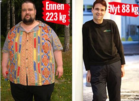 TV-laihduttaja pudotti 135 kiloa - katso! - Viihde - Ilta-Sanomat