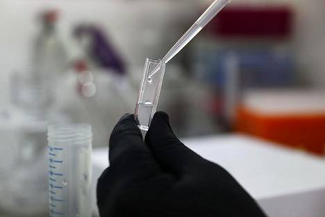 Israelilainen Sheba Medical Center kokeilee sylkitestiä, joka valmistajansa mukaan kertoo alle sekunnissa, onko näytteessä koronavirusta.