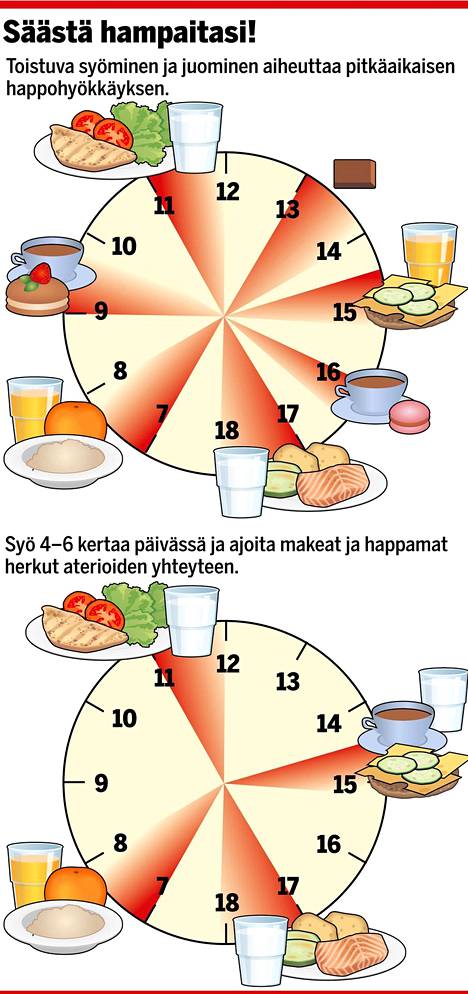 Yksi kuva kertoo, mikä voi ratkaista hampaiden reikiintymisessä - Terveys -  Ilta-Sanomat