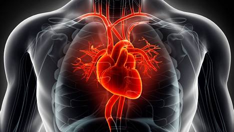 Sydämeenkin voi kertyä ylimääräistä rasvaa, ja ilmiö on monella tapaa haitallinen.