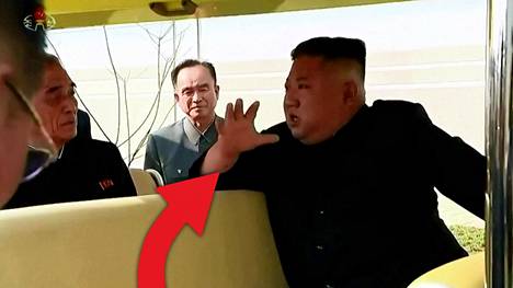 Tämä pieni jälki Kim Jong-unin ranteessa herätti epäilyt sydänoperaatiosta.