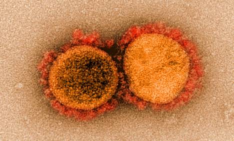 Uuden koronaviruksen SARS-CoV-2:n spike- eli piikkiproteiinit näkyvät selvästi elektronimikroskooppikuvassa. Virus käyttää piikkiproteiinia päästäkseen sisälle soluun.
