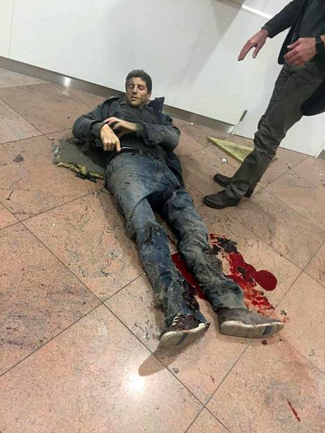 Sebastien Bellin loukkaantui vakavasti Brysselin lentokentälle tehdyissä terrori-iskuissa 22. maaliskuuta.