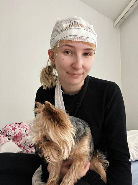 Epilepsiaan liittyy paljon tutkimuksia: kuvassa Vilhelmiinalla on käynnissä kahden vuorokauden mittainen EEG-tutkimus. 