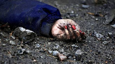 Kuva Irina Filkinan lakatuista kynsistä kosketti huhtikuussa ihmisiä ympäri maailman.