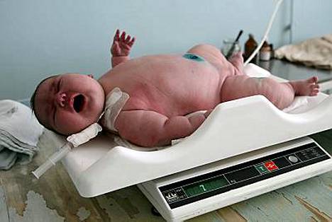 Venäläisnainen synnytti lähes 8-kiloisen vauvan - Ulkomaat - Ilta-Sanomat