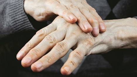 Parkinsonin taudin kolme pääoiretta ovat lepovapina, lihasjäykkyys ja liikkeiden hidastuminen.
