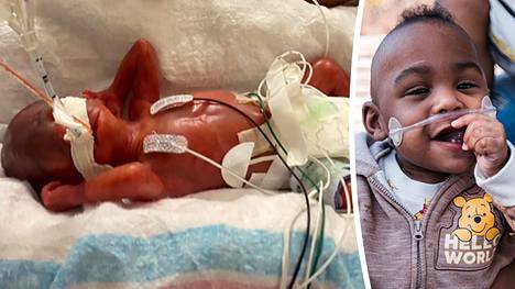Keskosena ja kaksosena syntynyt Curtis Means vietti tehohoidossa kolme kuukautta.