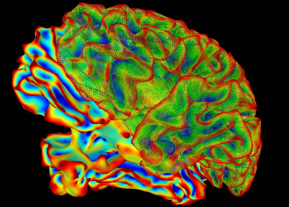 Tältä ihmisaivot näyttävät kuvankäsittelyohjelmalla muokatussa fMRI-kuvassa, joka tuo esille eri aivoalueiden aktivaatioita. Kuva ei liity Aalto-yliopiston tutkimukseen.